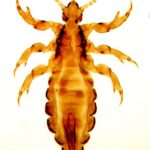 Picture of a Male Head louse
